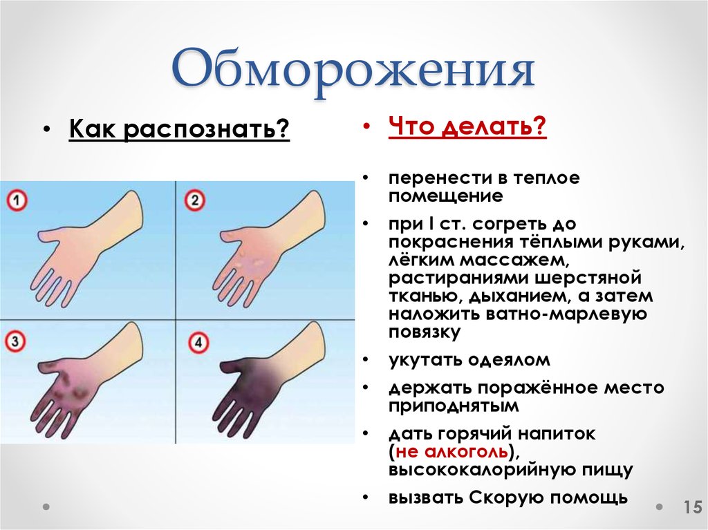 Первая помощь при обморожении. 1 Степень обморожения ПМП. Оказание первой помощи при отморожении 1 степени. ПМП при обморожении 1 степени. Первая помощь при обморожении 1 степени кратко.