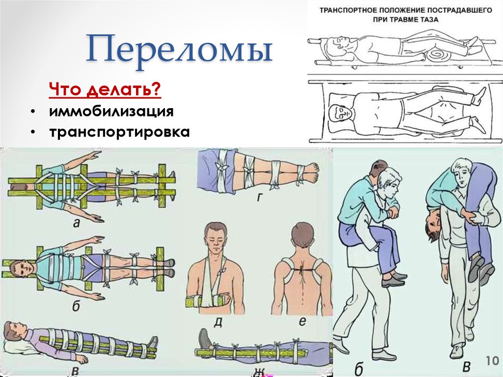 Презентация на тему неотложная помощь при переломах