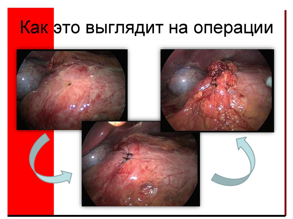 Как это выглядит на операции