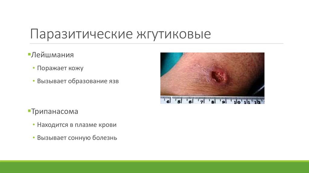 Паразитические жгутиковые