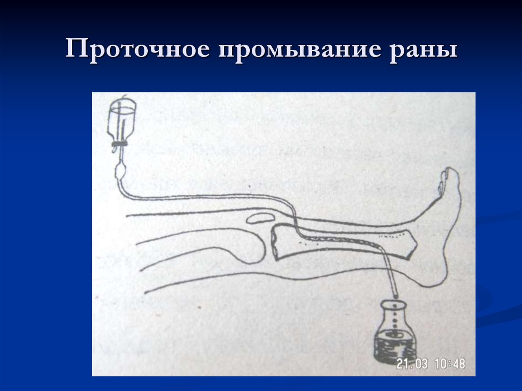 Промывание