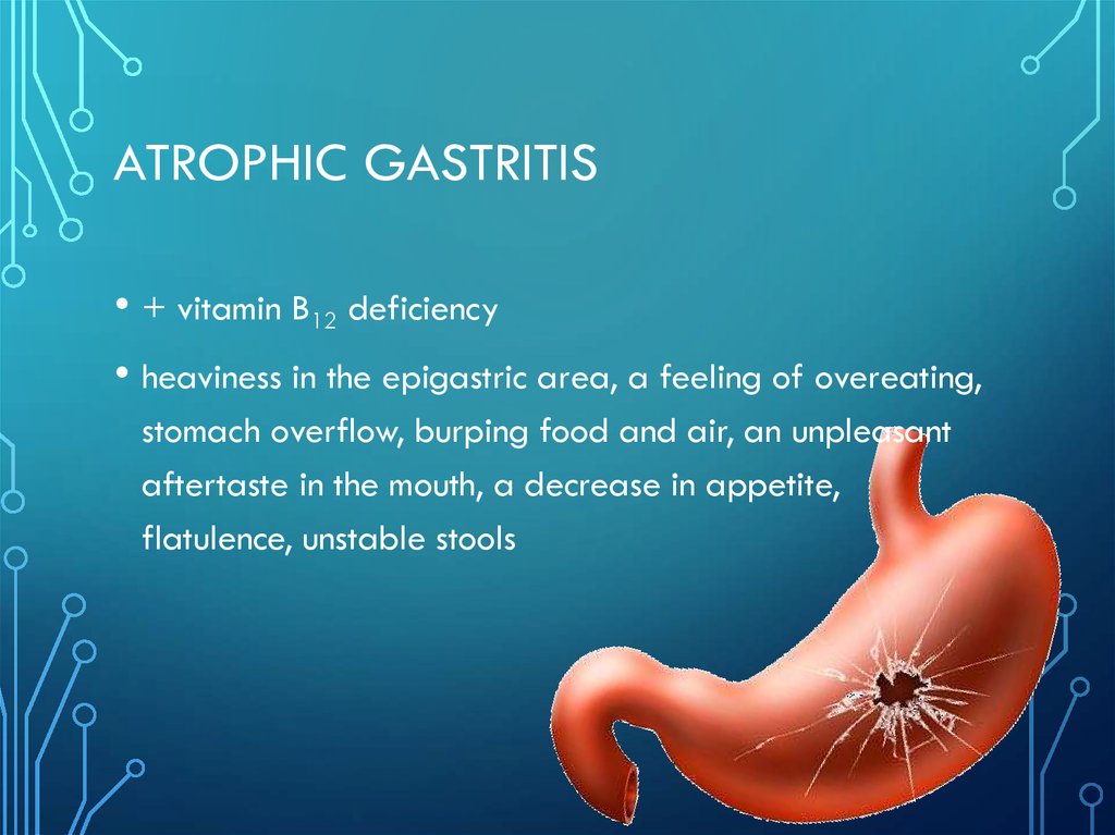 chronic-gastritis-online-presentation