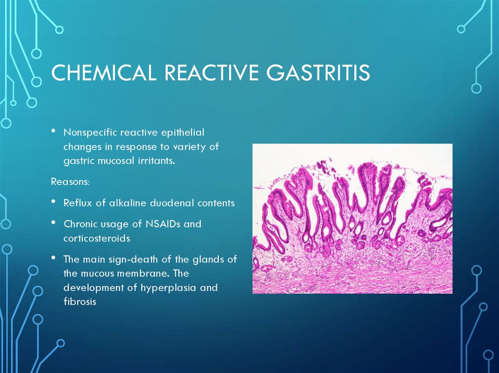 gastritis presentation