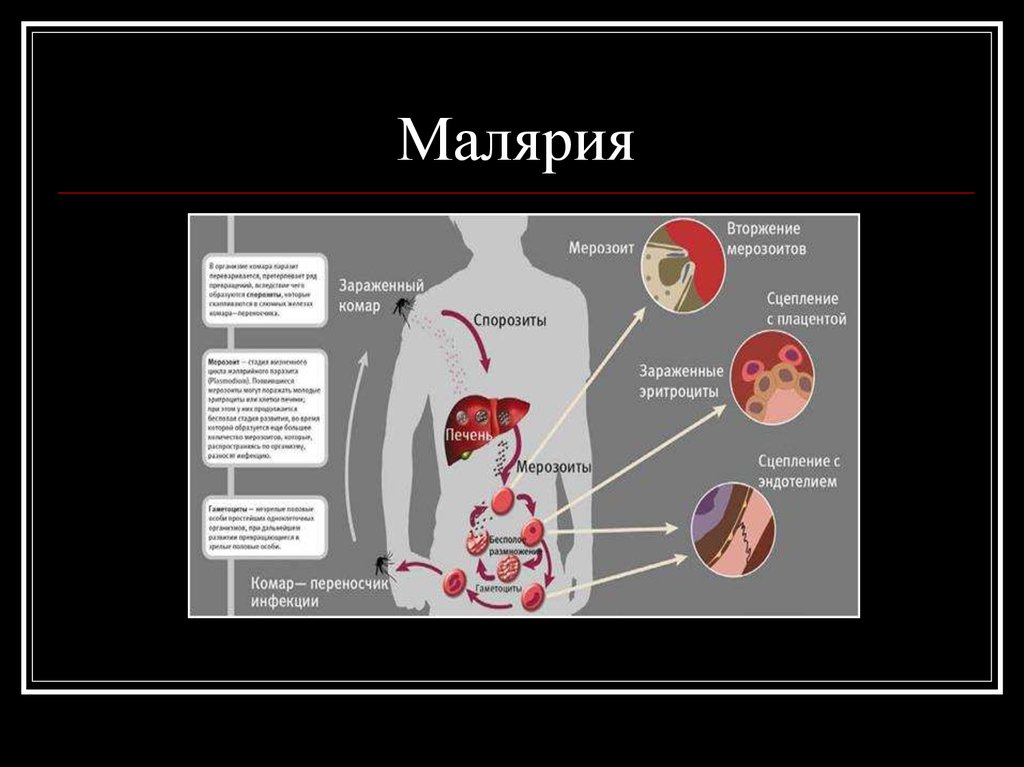 Малярия симптомы. Малярия это инфекционное заболевание. Малярийный плазмодий болезнь. Малярия органы поражения.