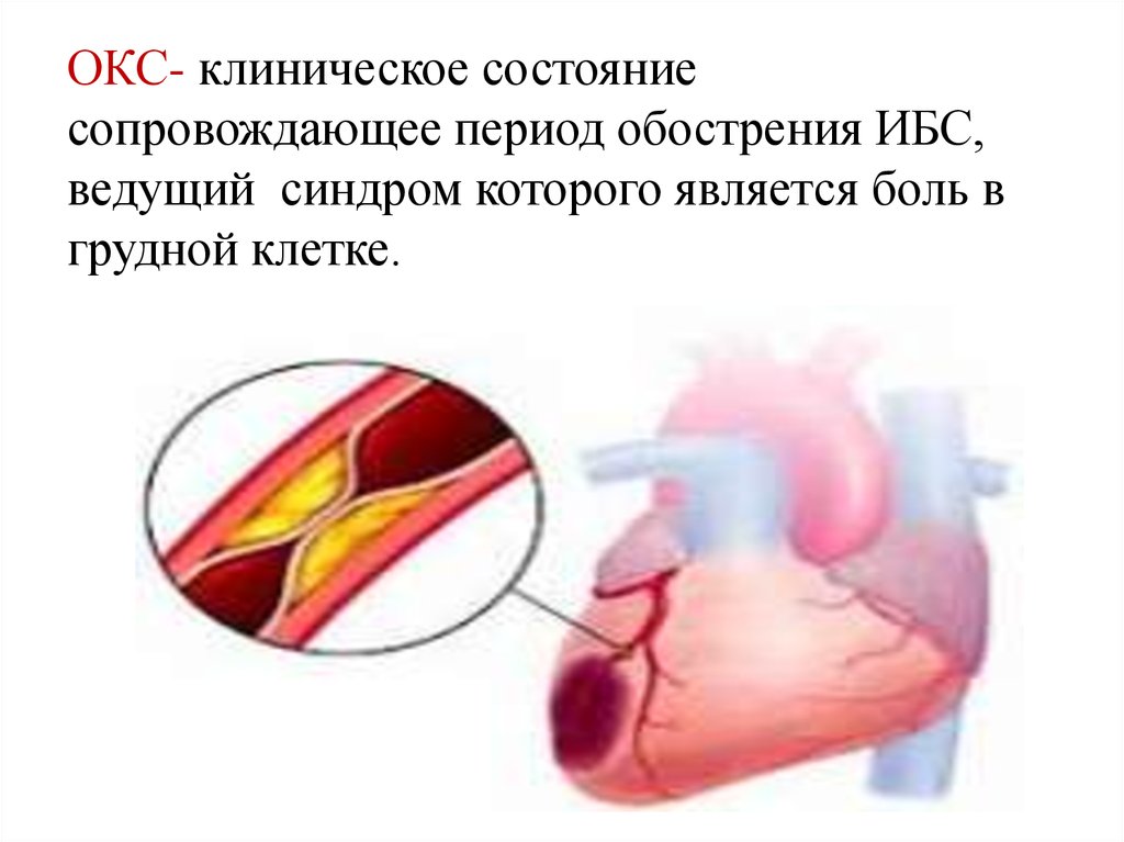 Постановка окс