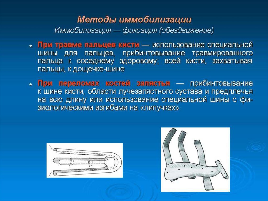 Травма кисти мкб. Презентация повреждения опорно-двигательного аппарата. Виды шин для иммобилизации. Иммобилизация пальцев кисти. Иммобилизация лучезапястного сустава и предплечья на всю длину.