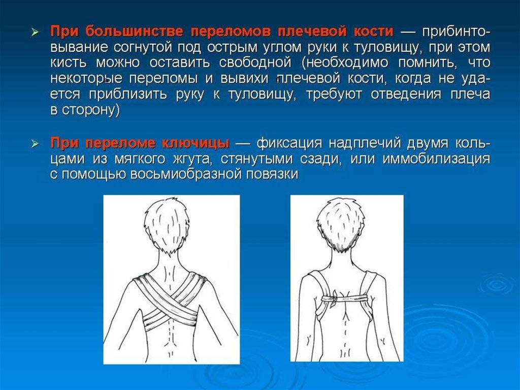 Повреждения плечевого пояса презентация