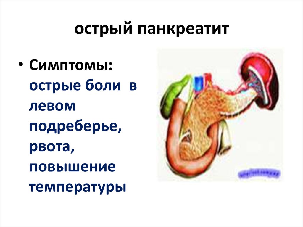 Признак панкреатита симптомы. Острый панкреатит симптомы. Острый панкреатит симптомы у взрослых. Специфические симптомы острого панкреатита. Специфические симптомы при остром панкреатите.