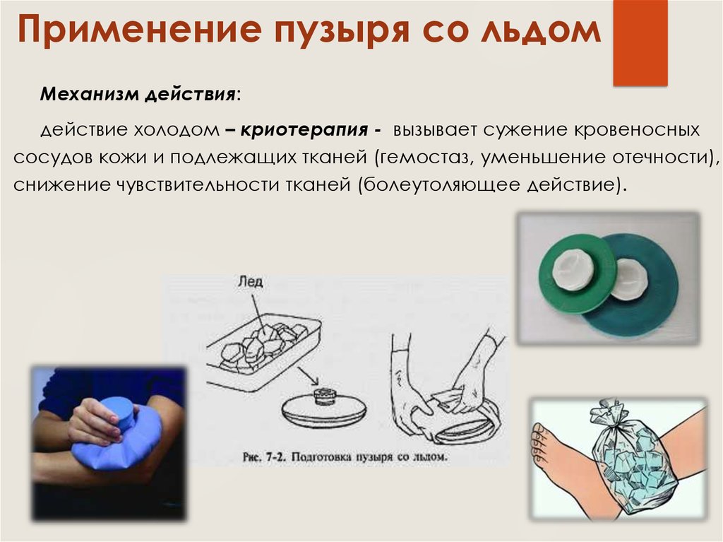 Местное применение холода. Постановка пузыря со льдом механизм действия. Грелка и пузырь со льдом алгоритм. Применение пузыря со льдом. Постановка грелки и пузыря со льдом.