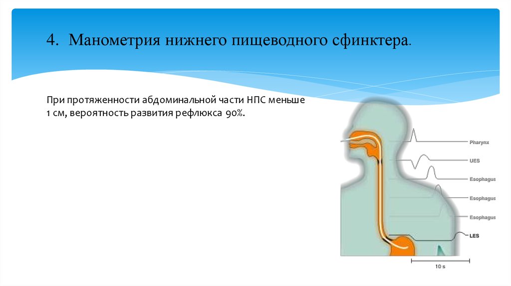 Верхний сфинктер пищевода. Нижний пищеводный сфинктер. Манометрия. Манометрия пищевода. Верхний пищеводный сфинктер.