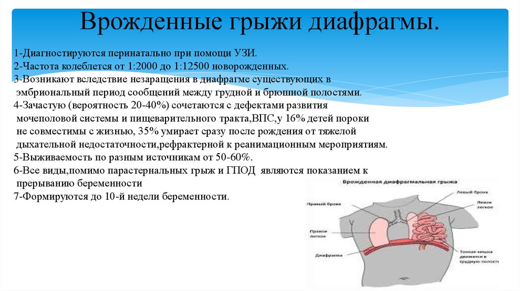 Диафрагмальная грыжа клиническая картина