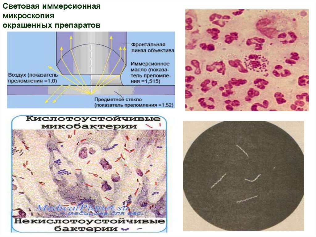 Иммерсионная микроскопия. Иммерсионная световая микроскопия. Световая микроскопия сухая и иммерсионная. Световая микроскопия с иммерсионным объективом. Техника иммерсионной микроскопии микробиология.