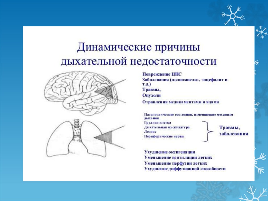 Дыхательная недостаточность заболевания. Острая дыхательная недостаточность. Причины дыхательной недостаточности. Острая дыхательная недостаточность причины. При острой дыхательной недостаточности.