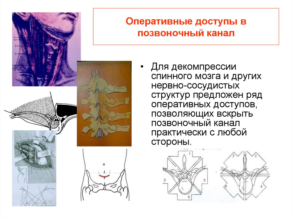 Дегенеративные заболевания позвоночника презентация