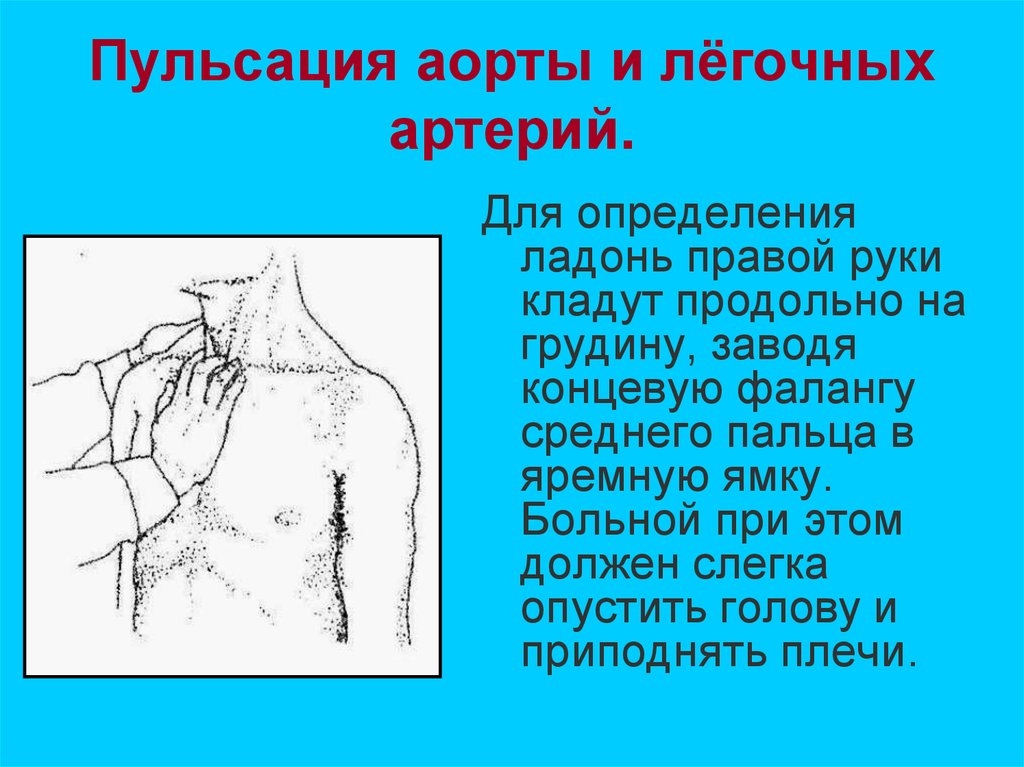 Видна пульсация. Пульсация в яремной ямке. Пальпация пульсации аорты. Выявление пульсации аорты. Пульсация брюшной артерии.