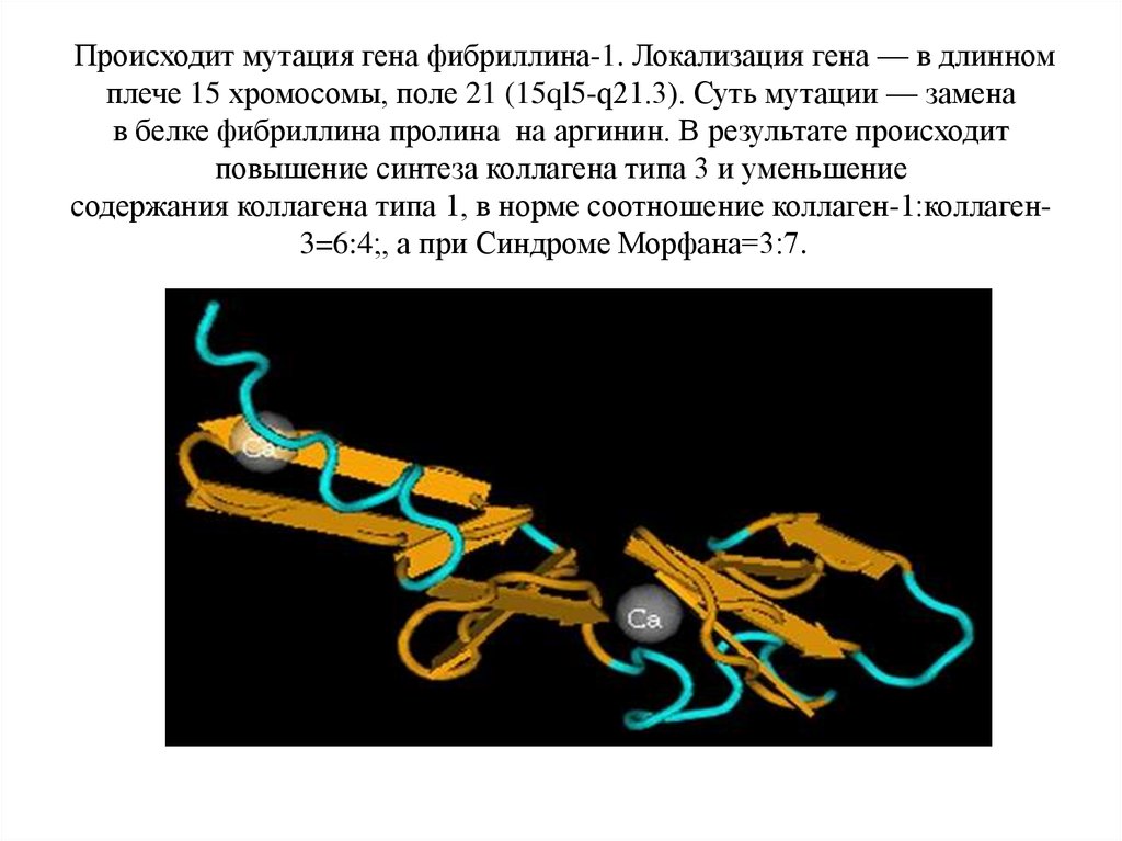 Хромосомы гены мутации. Синтез гликопротеина фибриллина-1 что это. Мутация Гена фибриллина. Синдром Марфана генное. Синдром Марфана фибриллин 1.