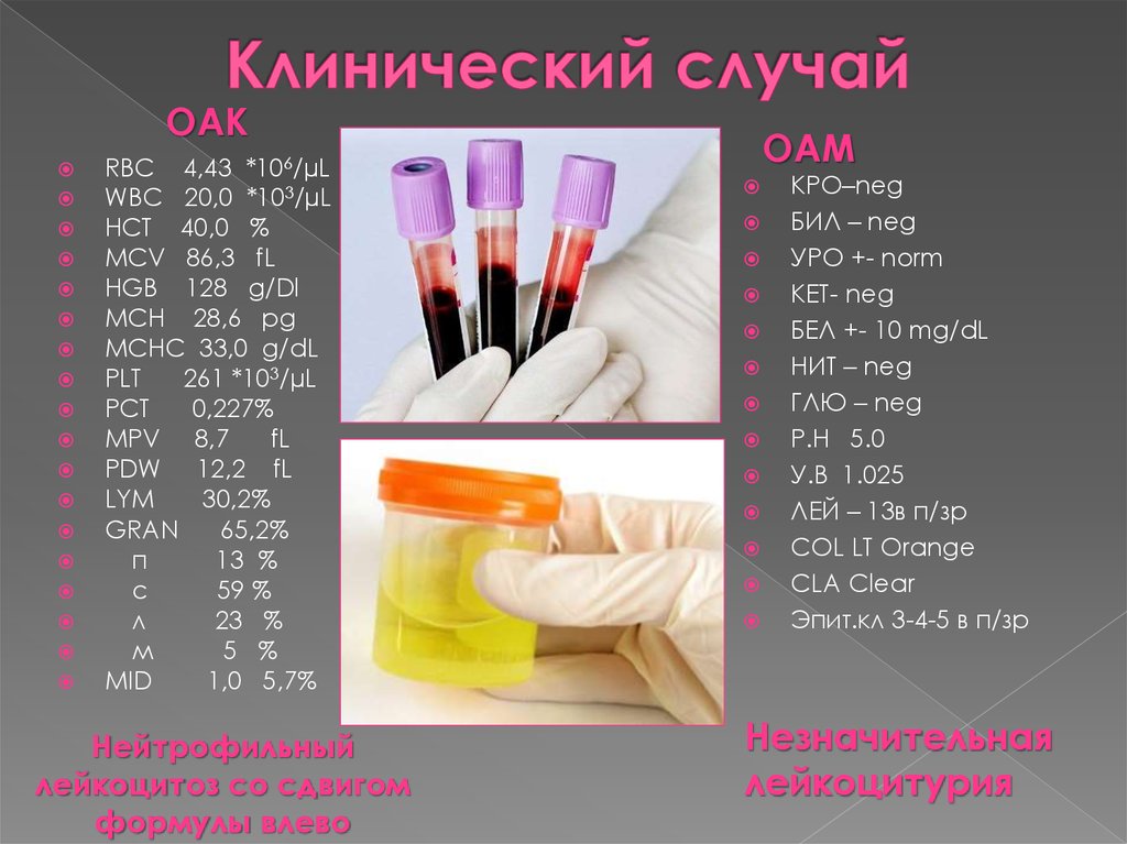 Клинический случай