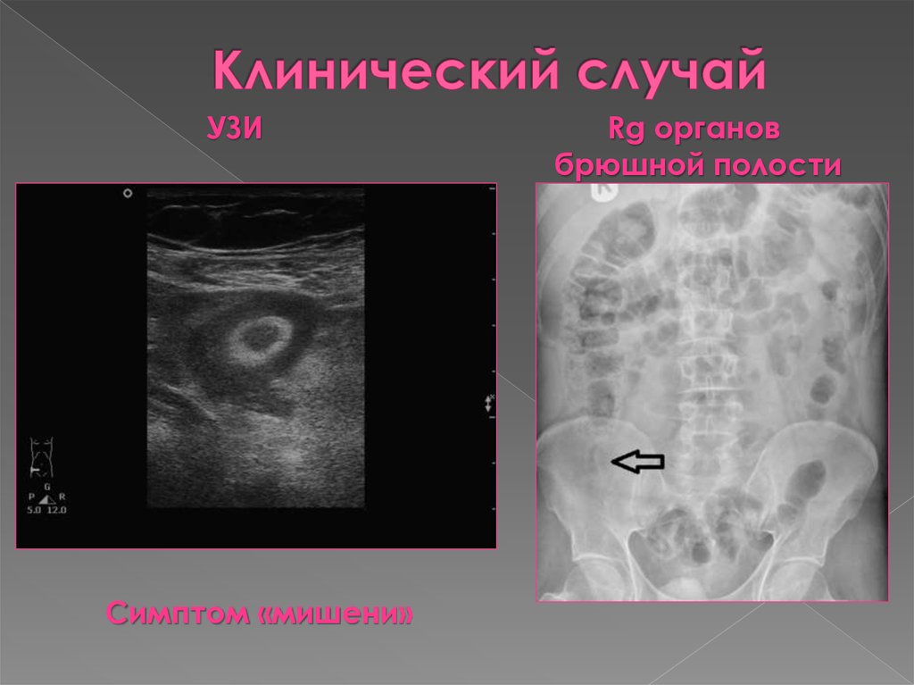 Клинический случай