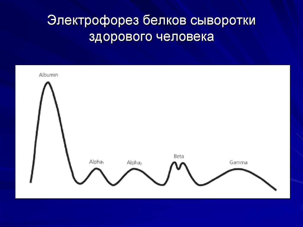 Электрофорез белков