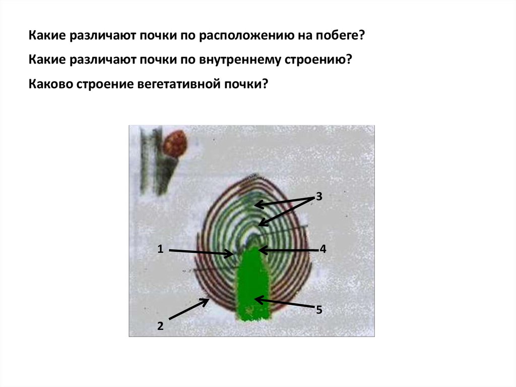 Зачаточные почки. Зачаточная почка и конус нарастания. Вегетативная почка конус нарастания. Строение почки конус нарастания. Лист, конус нарастания, зачаточный стебель..