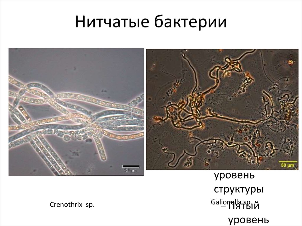 Нитевидные бактерии. Нитчатые бактерии. Нитевидные микроорганизмы. Нитчатые формы бактерий. Нитевидные формы бактерий.