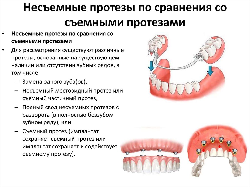 Штифтовые конструкции в ортопедической стоматологии презентация