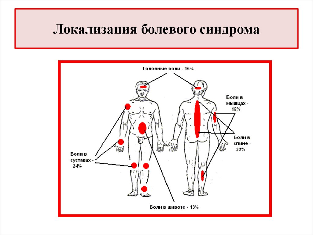 Схема боли в спине. Локализация болевого синдрома. Локализация боли в спине. Локализация боли схема. Локализация это.