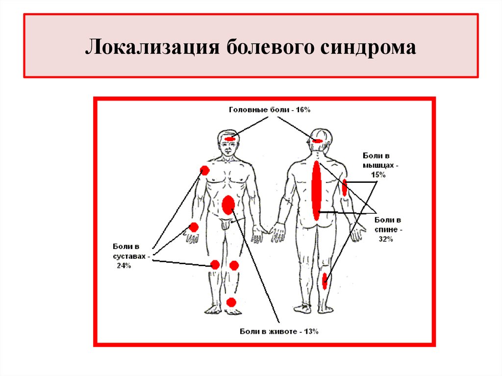 Локализация боли в спине на картинках