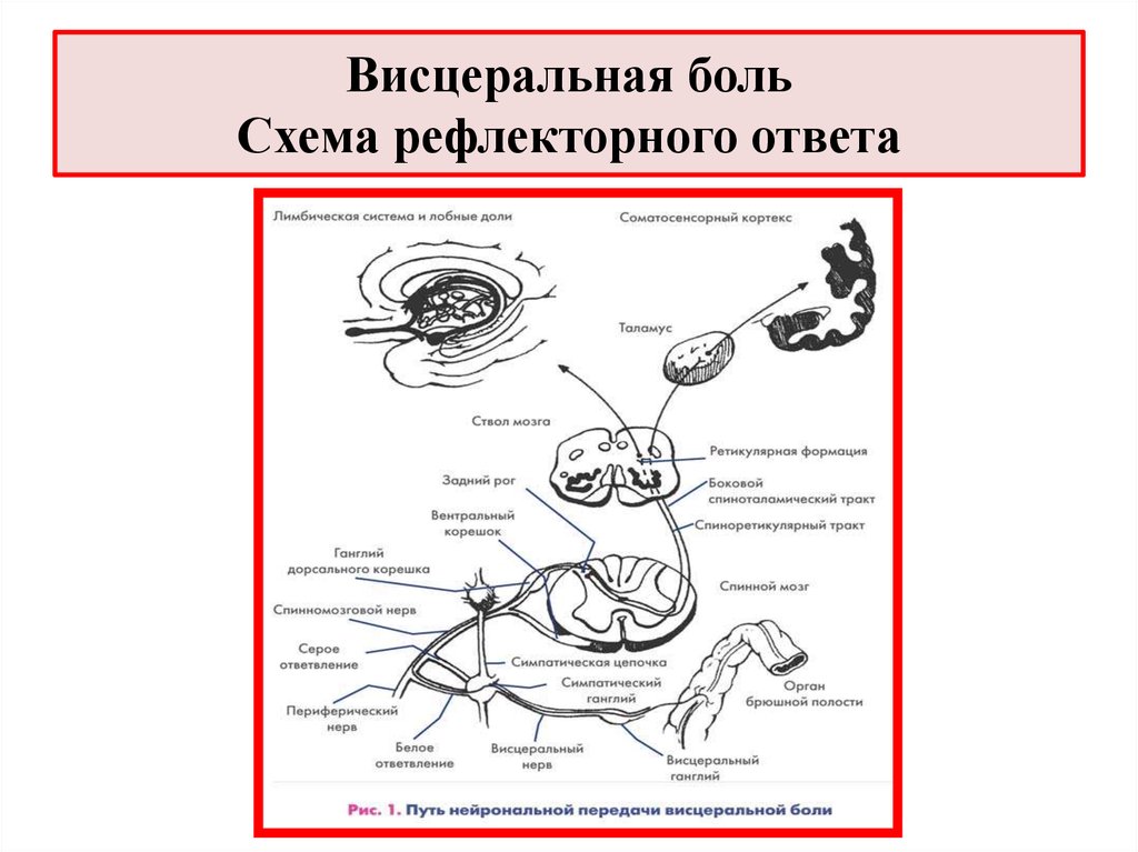 Рефлекторные боли. Схема строения сенсорной системы анализатора. Висцеральный анализатор рефлекс. Висцеральная сенсорная система схема. Центры болевой сенсорной системы физиология.