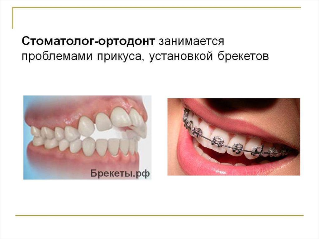 Ортодонтическое лечение детей презентация