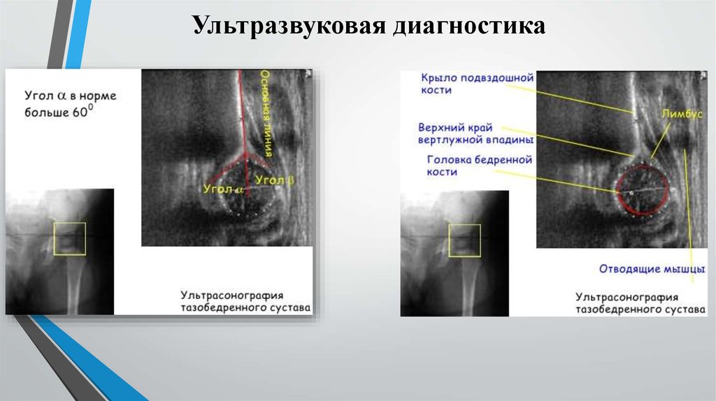 Ультразвуковая диагностика