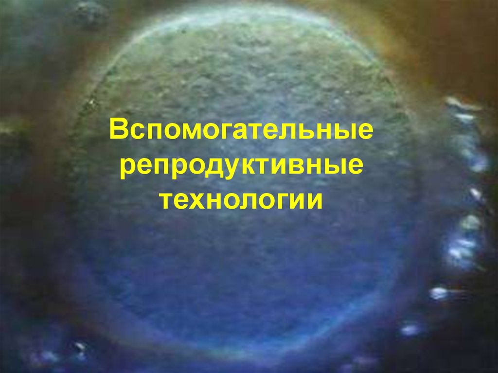 Вспомогательные репродуктивные технологии. Религия и вспомогательные репродуктивные технологии. Вспомогательные репродуктивные технологии Сотворение мира.