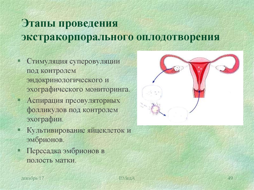 Оплодотворение в полости матки. Этапы экстракорпоральное оплодотворение. Искусственное оплодотворение этапы. Стимуляция яичников. Этапы экстракорпорального оплодотворения.