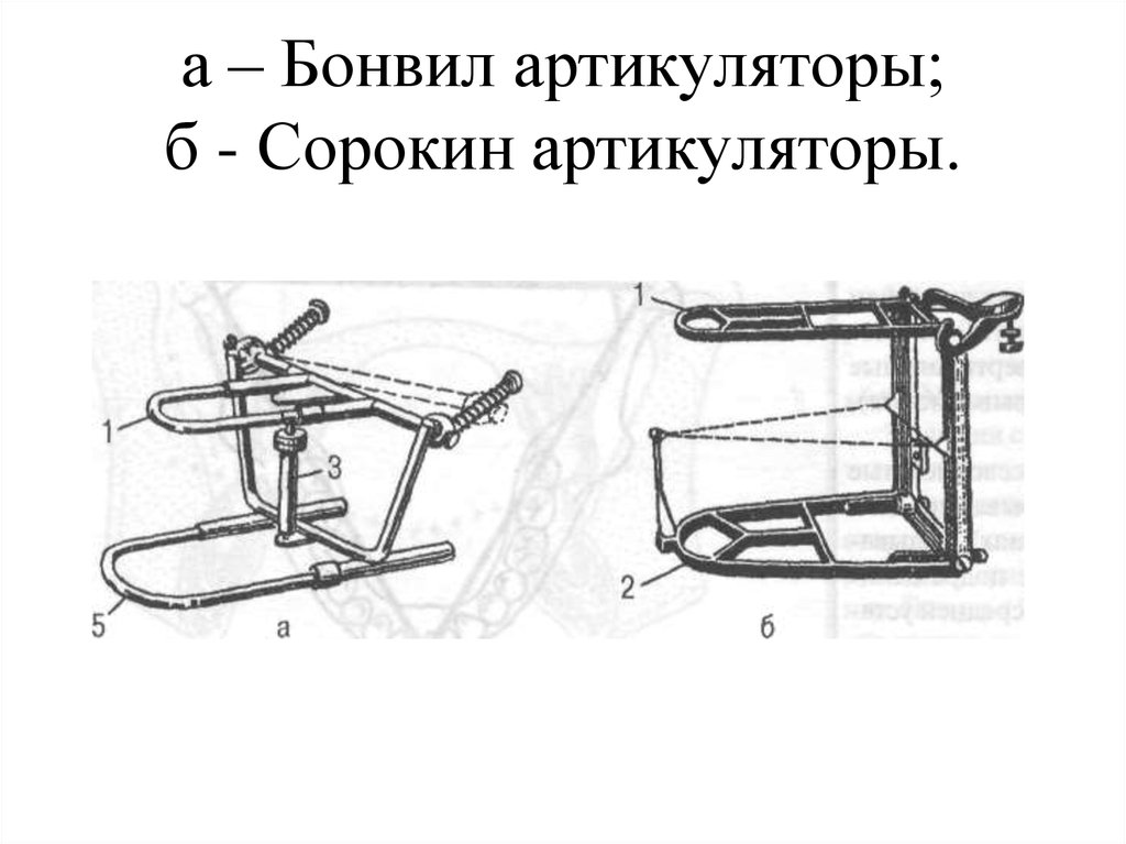 Окклюдатор и артикулятор презентация