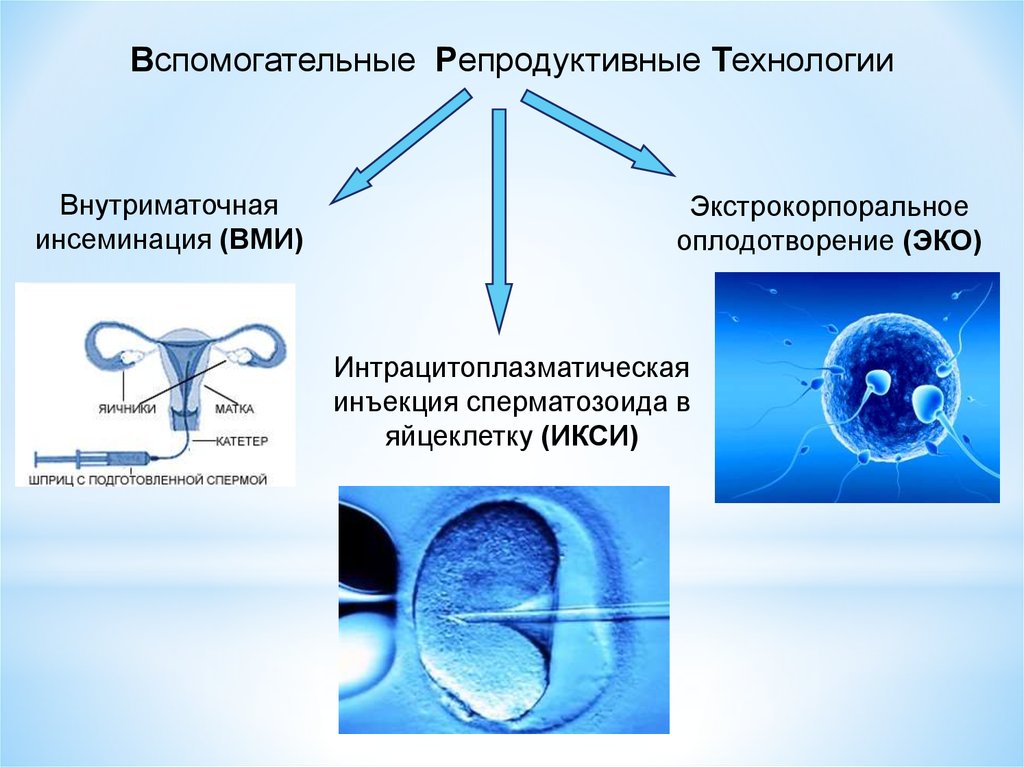 Эко с донорской яйцеклеткой форум. Вспомогательные репродуктивные технологии (ВРТ). Репродуктивные технологии виды. Эко экстракорпоральное оплодотворение. Вспомогательные репродуктивные технологии классификация.