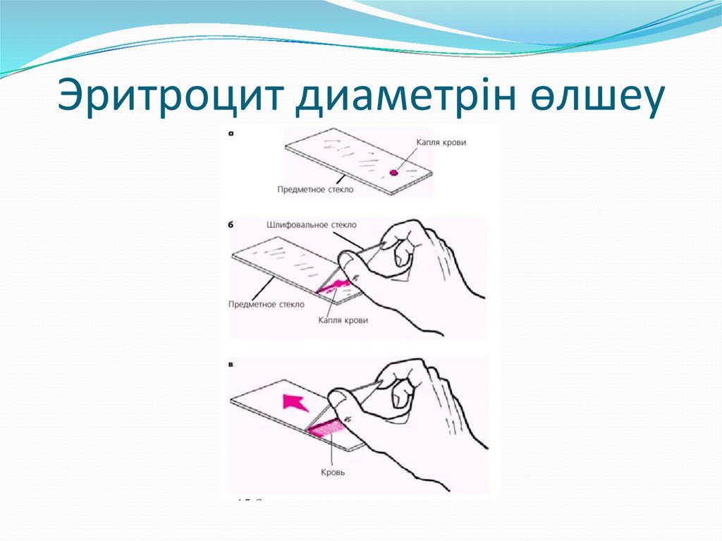 Эритроцит диаметрін өлшеу