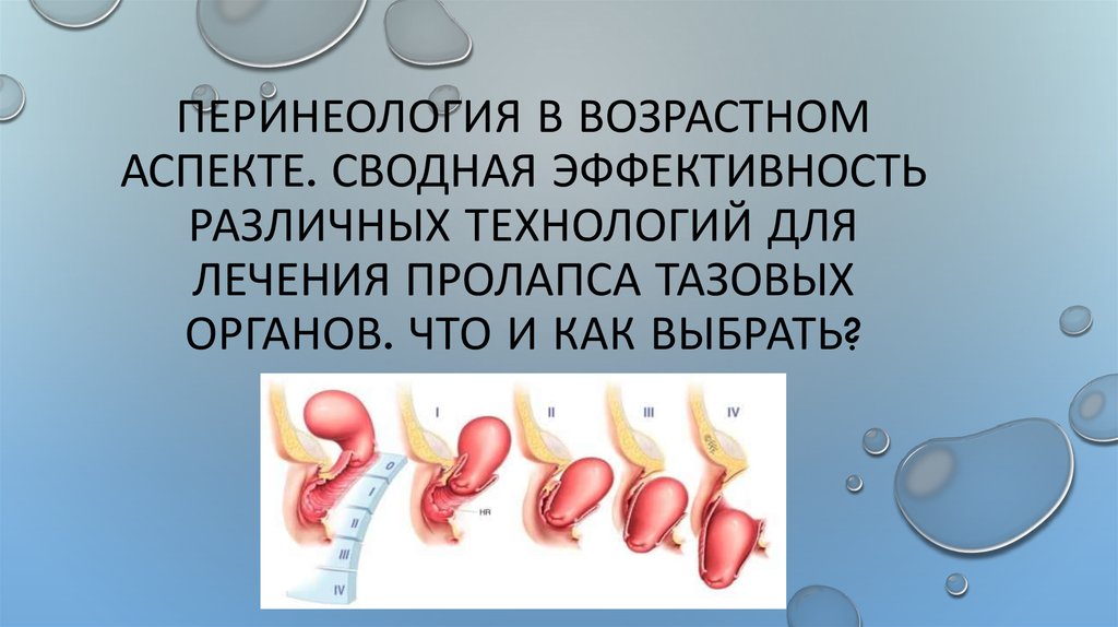 Операция пролапса органов малого таза. Пролапс тазовых органов степени. Пролапс тазовых органов классификация. Классификация пролапса тазовых органов у женщин. Пролапс тазовых органов презентация.