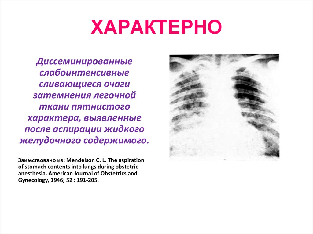 Паранойяльный синдром презентация