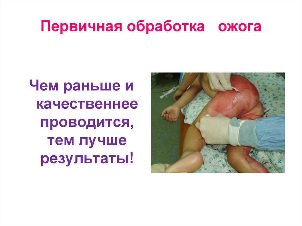 Первичная обработка ожога