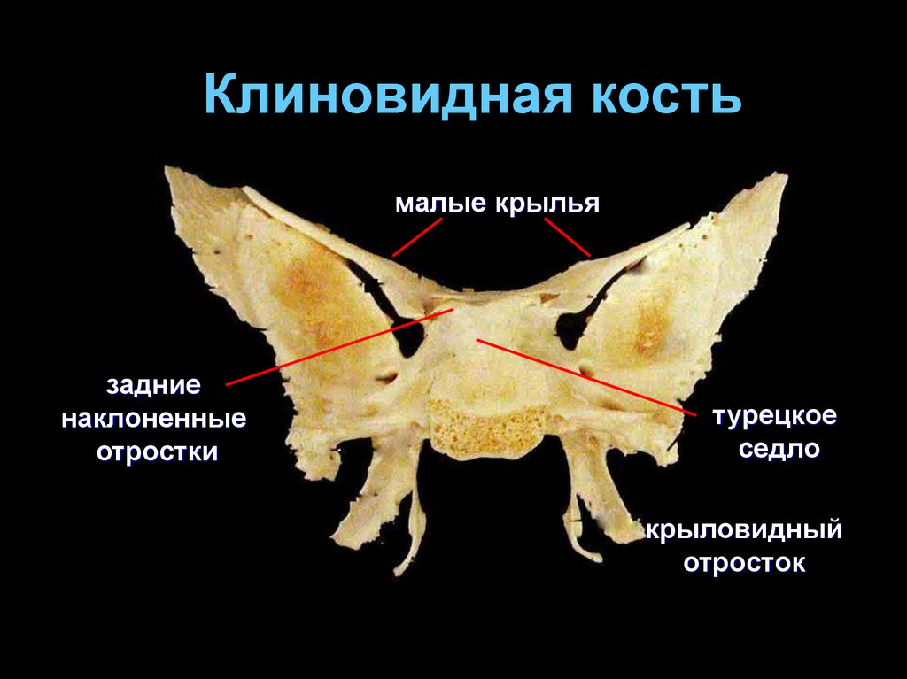 Отростки клиновидной кости. Клиновидная кость: большие Крылья и крыловидные отростки.. Турецкое седло клиновидной кости черепа. Крыловидный отросток клиновидной кости. Малые Крылья клиновидной кости в черепе.