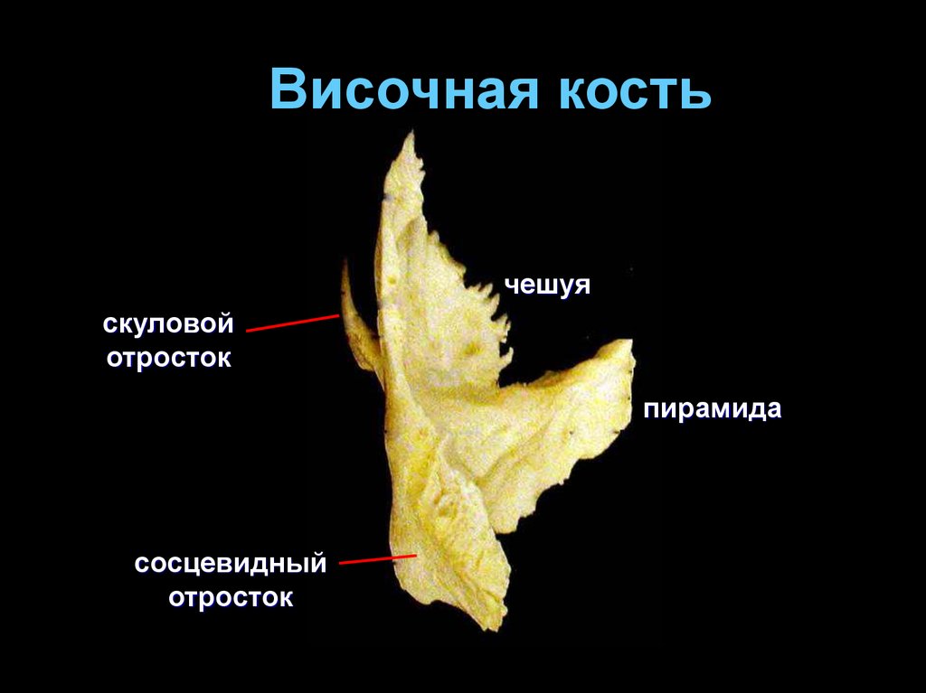 Изменения височной кости. Пирамида височной кости анатомия. Височная кость анатомия строение. Пирамида (каменистая часть) височной кости. Височная кость топография.