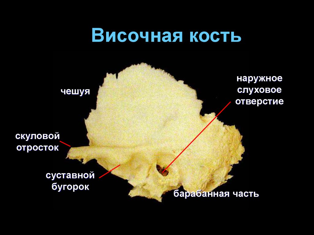 Височная кость черепа. Чешуйчатая часть височной кости. Чешуя височной кости. Височная кость чешуя. Височная кость Чешуйчатая часть.