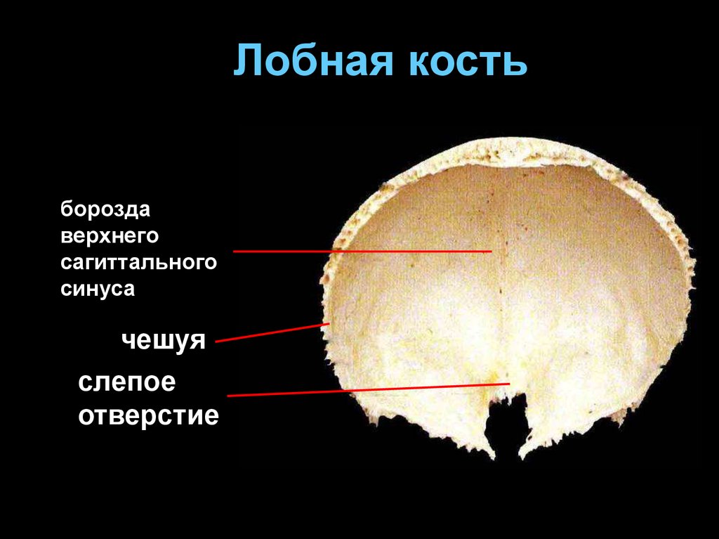 Лобная и теменная кость. Кости черепа лобная кость. Борозда верхнего сагиттального синуса лобной кости. Лобная кость слепое отверстие. Слепое отверстие лобной кости.