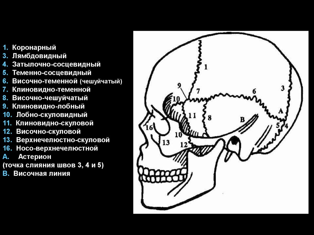 Между теменной костью и затылочной. Теменно-затылочный шов черепа. Швы черепа анатомия рентген. Рентгеноанатомия скуловой кости. Рентгеноанатомия черепа турецкое седло.