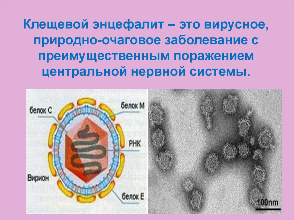 Клещевой энцефалит – это вирусное, природно-очаговое заболевание с преимущественным поражением центральной нервной системы.