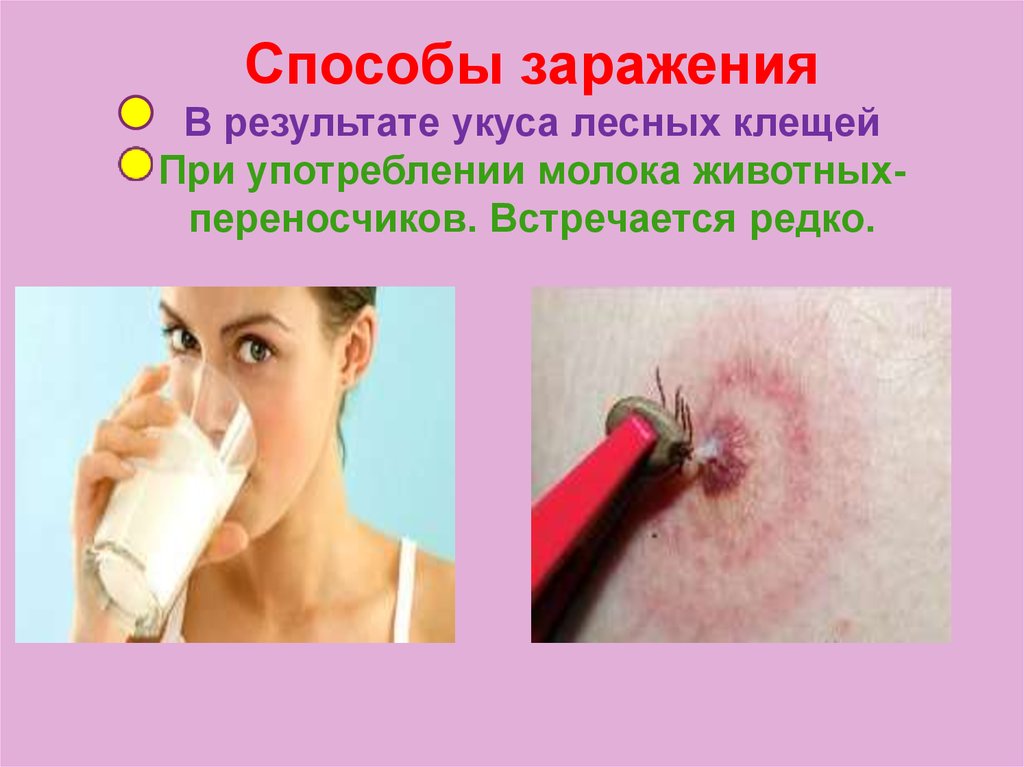 Способы заражения В результате укуса лесных клещей При употреблении молока животных-переносчиков. Встречается редко.