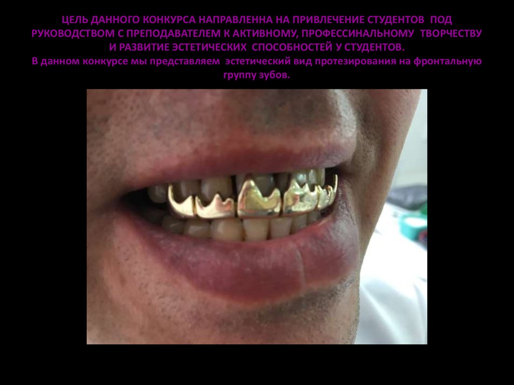 ЦЕЛЬ ДАННОГО КОНКУРСА НАПРАВЛЕННА НА ПРИВЛЕЧЕНИЕ СТУДЕНТОВ ПОД РУКОВОДСТВОМ С ПРЕПОДАВАТЕЛЕМ К АКТИВНОМУ, ПРОФЕССИНАЛЬНОМУ