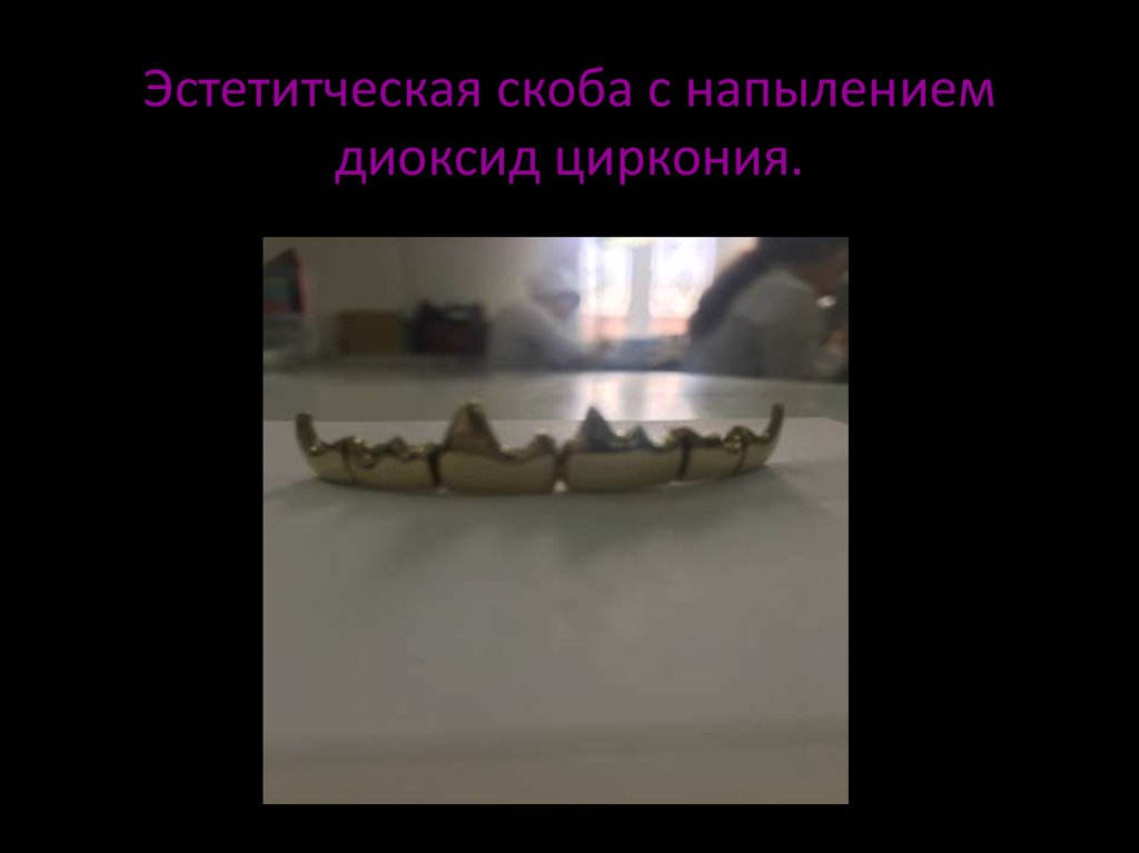 Эстетитческая скоба с напылением диоксид циркония.