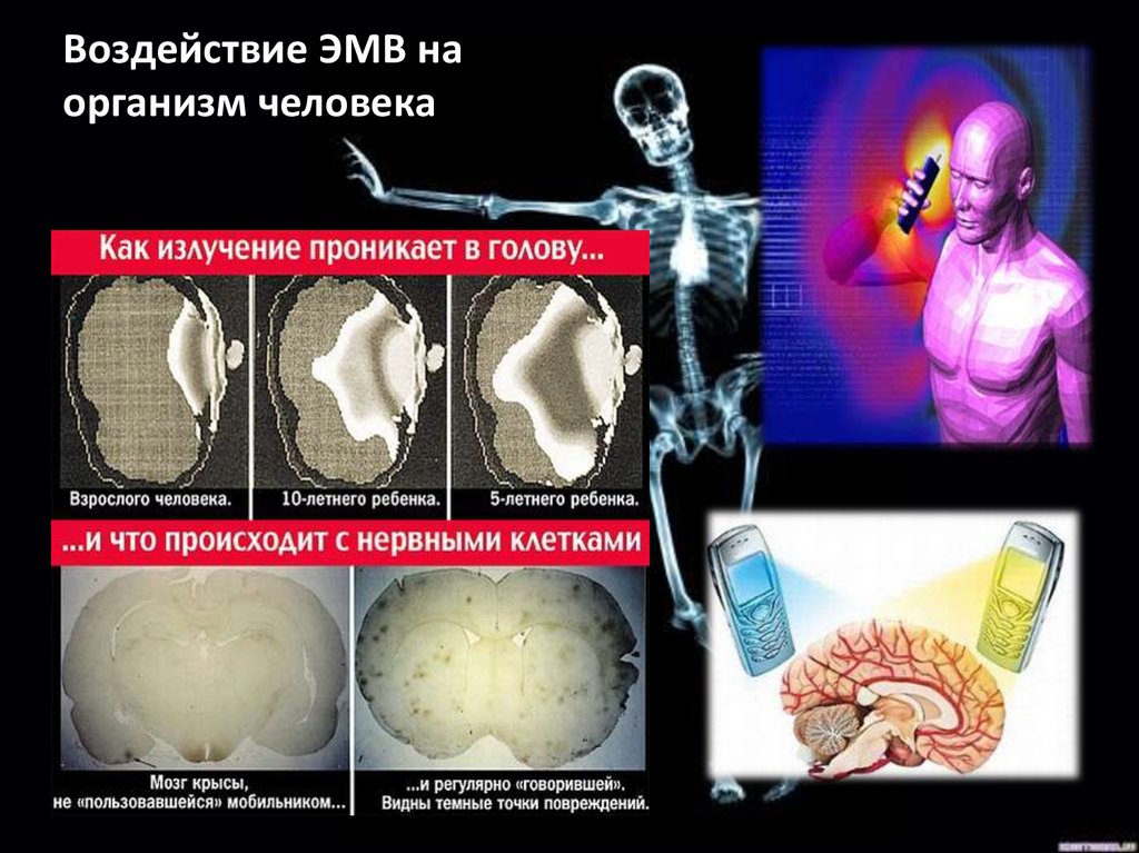 Презентация электромагнитное излучение влияние на организм человека