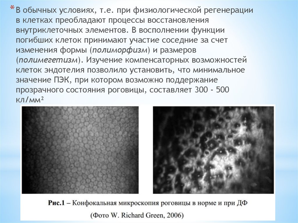 Роговая дистрофия. Эндотелиальная микроскопия роговицы норма. Конфокальная эндотелиальная микроскопия роговицы в норме. Клетки эндотелия роговицы. Регенерация клеток эндотелия роговицы.